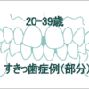 前歯のすきっ歯矯正治療例（20歳～39歳）
